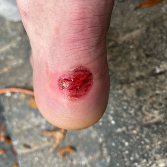 Meet your Posher, Matthew - Picture 3 of 15